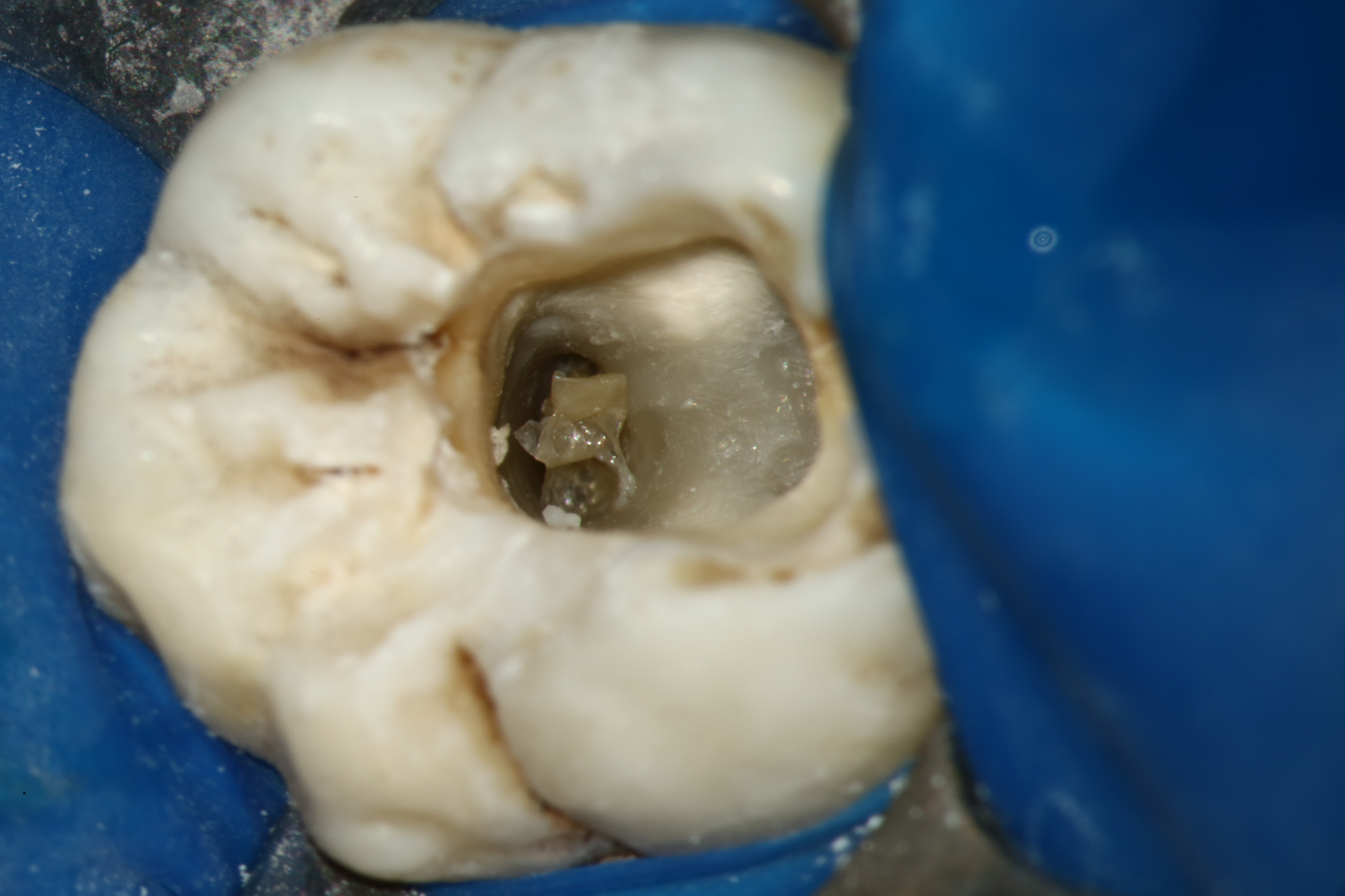As diferentes magnificações proporcionadas pelo Microscópio Operatório