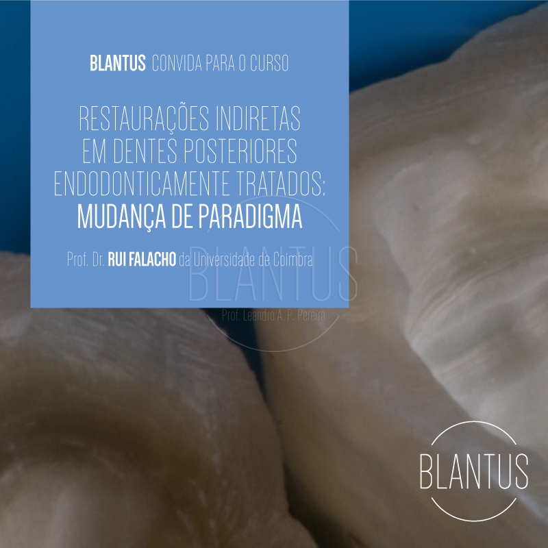 Blantus convida para o curso Restaurações indiretas em dentes posteriores endometicamente tratados: mudança de paradigma
