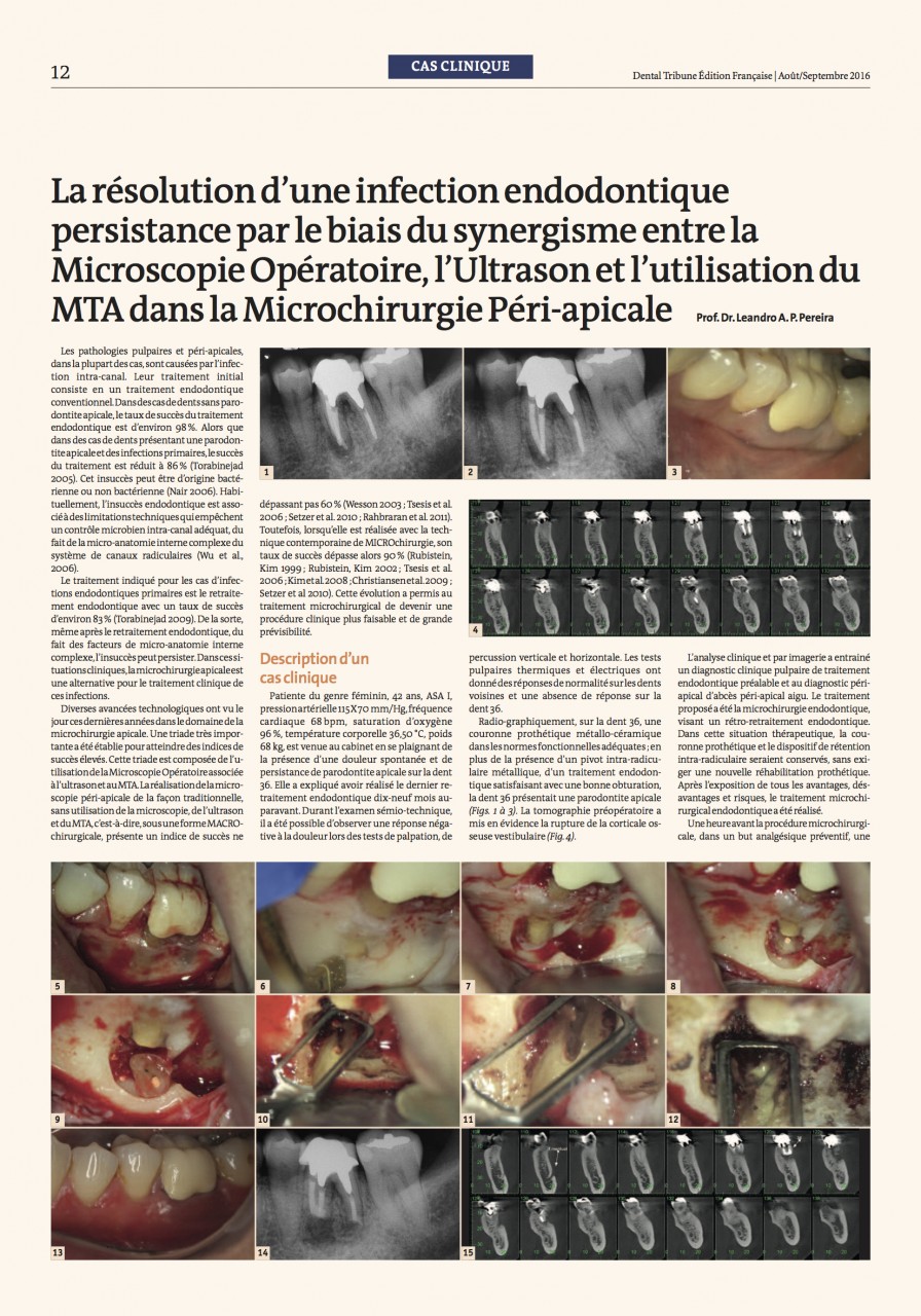 Artigo de Microcirurgia que Publiquei na França