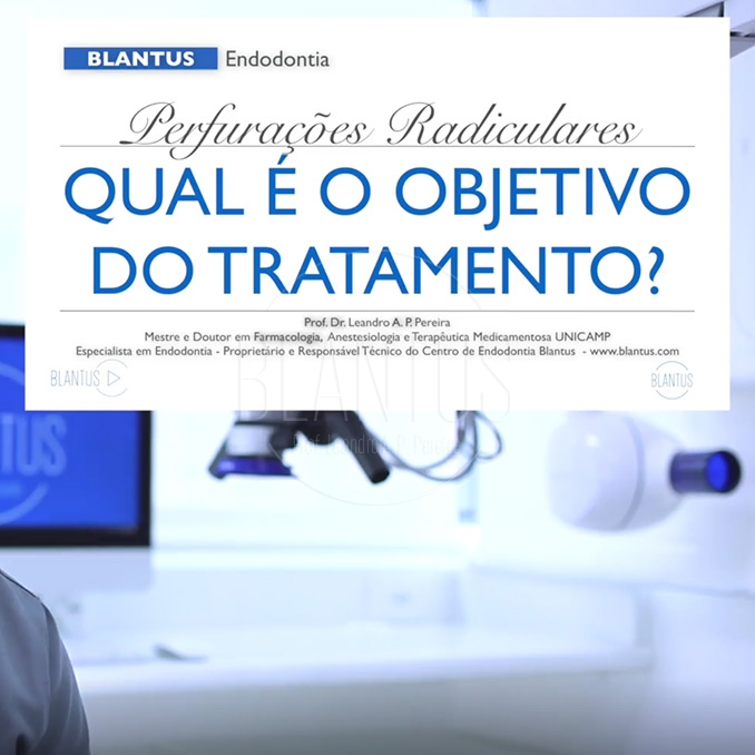 Endodontia Simples e Eficaz